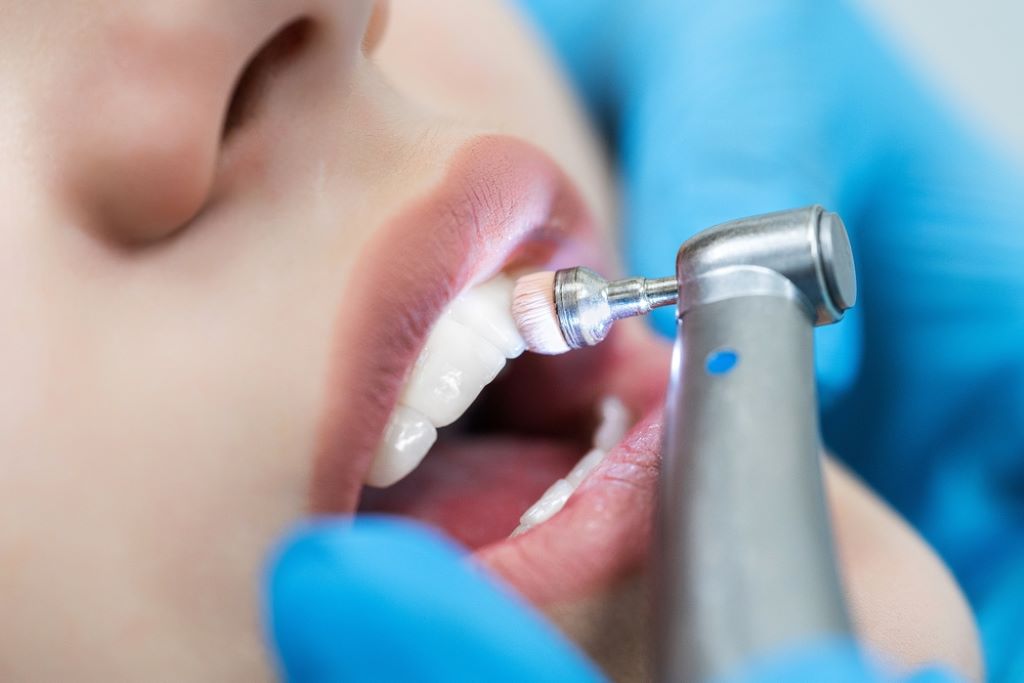 dental cleanings in winnipeg mb