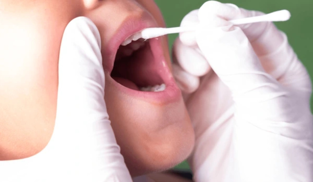 fluoride treatments near you