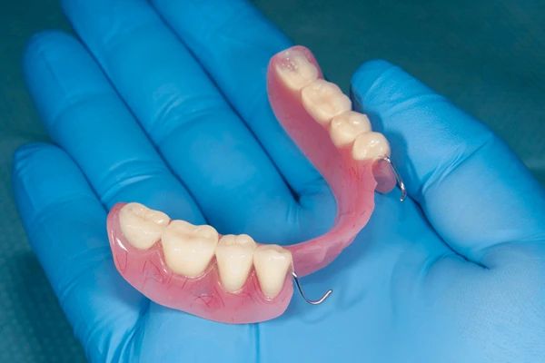 partial dentures in winnipeg, mb