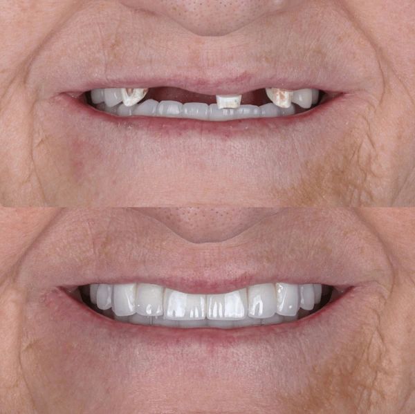 restorative dentistry in winnipeg, mb